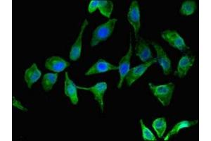 Immunofluorescent analysis of Hela cells using ABIN7171891 at dilution of 1:100 and Alexa Fluor 488-congugated AffiniPure Goat Anti-Rabbit IgG(H+L) (Tspan-8 antibody  (AA 110-205))