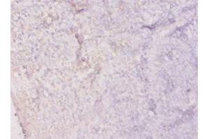 Immunohistochemistry of paraffin-embedded human tonsil tissue using ABIN7156020 at dilution of 1:20 (HPRT1 antibody  (AA 2-218))