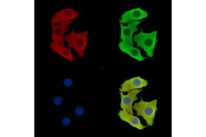 ABIN7097067 and ABIN7101134 staining Hela cells by IF/ICC. (TMEM63C antibody)