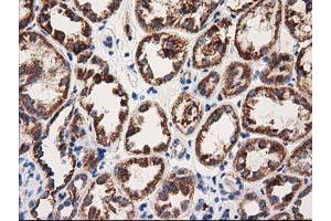 Immunohistochemical staining of paraffin-embedded Human Kidney tissue using anti-MMAA mouse monoclonal antibody. (MMAA antibody)