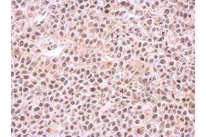 IHC-P Image Immunohistochemical analysis of paraffin-embedded HeLa xenograft, using PSMC6, antibody at 1:500 dilution. (PSMC6 antibody)