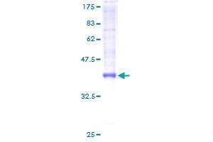 TTLL3 Protein (AA 1-101) (GST tag)