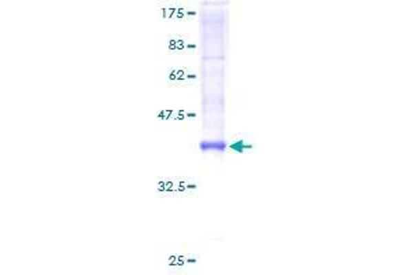 TTLL3 Protein (AA 1-101) (GST tag)