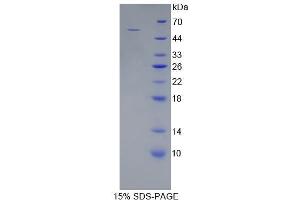 SDS-PAGE (SDS) image for Wingless-Type MMTV Integration Site Family, Member 10A (WNT10A) (AA 108-343) protein (His tag,GST tag) (ABIN1878236)