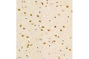 Immunohistochemistry of paraffin embedded rat brain using PHF10 (ABIN7075029) at dilution of 1:1200 (400x lens) (PHF10 antibody)