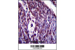MAGED4B Antibody immunohistochemistry analysis in formalin fixed and paraffin embedded human heart tissue followed by peroxidase conjugation of the secondary antibody and DAB staining. (MAGED4B antibody  (AA 328-357))