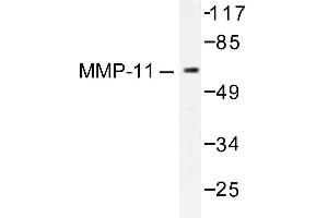Image no. 1 for anti-Matrix Metallopeptidase 11 (Stromelysin 3) (MMP11) antibody (ABIN265523) (MMP11 antibody)