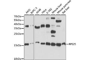 Western blot analysis of extracts of various cell lines, using RPS25 antibody (ABIN7270020) at 1:1000 dilution.