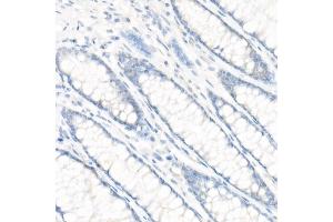 Immunohistochemistry of paraffin-embedded Human colon (negative control sample) using CD147/BSG antibody (ABIN7265838) at dilution of 1:100 (40x lens). (CD147 antibody)