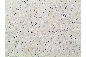 Immunohistochemistry (IHC) image for anti-Ephrin B2 (EFNB2) (C-Term) antibody (ABIN6261455)