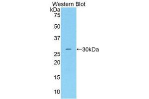 Western Blotting (WB) image for anti-Complement Factor D (CFD) (AA 1-263) antibody (ABIN3205985) (Adipsin antibody  (AA 1-263))