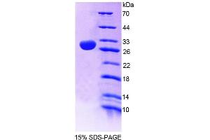 SDS-PAGE analysis of Human CNP Protein.