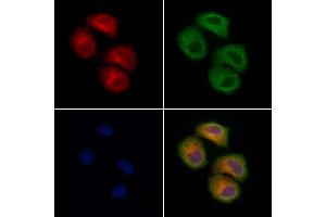 ABIN7094629 and ABIN7098679 staining Hela cells by IF/ICC. (TOM1L2 antibody  (Internal Region))