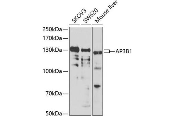 AP3B1 anticorps  (AA 895-1094)