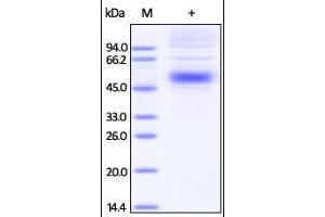 Human IL-5 R alpha, His Tag on SDS-PAGE under reducing (R) condition. (IL5RA Protein (AA 21-335) (His tag))