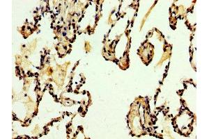 IHC image of ABIN7149882 diluted at 1:500 and staining in paraffin-embedded human lung tissue performed on a Leica BondTM system.