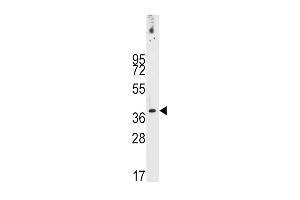 Western blot analysis of anti-PDX1 Antibody (T11) (ABIN388774 and ABIN2839109) in NCI- cell line lysates (35 μg/lane).