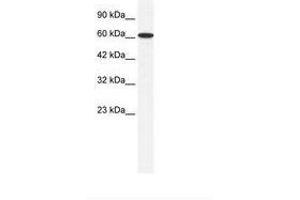 Image no. 1 for anti-Zinc Finger Protein 266 (ZNF266) (AA 27-76) antibody (ABIN6735986)