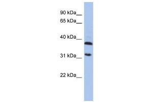 ASPA antibody used at 1 ug/ml to detect target protein. (ASPA antibody)