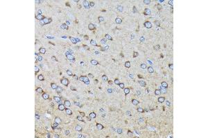Immunohistochemistry of paraffin-embedded rat brain using R Rabbit mAb (ABIN7269840) at dilution of 1:100 (40x lens). (RALBP1 antibody)