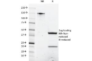 SDS-PAGE Analysis Purified CD8A Mouse Monoclonal Antibody (C8/1035). (CD8 alpha antibody)