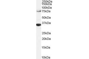 ABIN184590 (2µg/ml) staining of Hela lysate (RIPA buffer, 1. (ORC3 antibody  (C-Term))