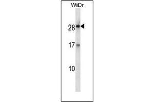 Western blot analysis of KLK12 / Kallikrein-12 Antibody (Center) in WiDr cell line lysates (35ug/lane). (Kallikrein 12 antibody  (Middle Region))
