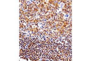 Immunohistochemical analysis of paraffin-embedded H. (NFKB1 antibody)