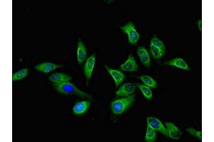 Immunofluorescent analysis of Hela cells using ABIN7158780 at dilution of 1:100 and Alexa Fluor 488-congugated AffiniPure Goat Anti-Rabbit IgG(H+L) (CTSA antibody  (AA 30-327))