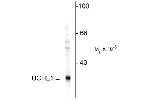 Western blot of rat hippocampal homogenate showing specific immunolabeling of the ~ 24k UCHL1 protein. (UCHL1 antibody)