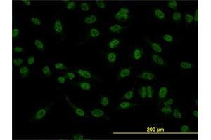 Immunofluorescence of monoclonal antibody to SMAD5 on HeLa cell. (SMAD5 antibody  (AA 105-182))