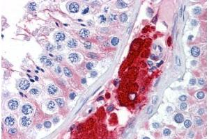 Human Testis: Formalin-Fixed, Paraffin-Embedded (FFPE) (CDC123 antibody  (AA 1-337))