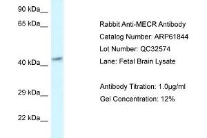 Western Blotting (WB) image for anti-Mitochondrial Trans-2-Enoyl-CoA Reductase (MECR) (C-Term) antibody (ABIN2788923) (MECR antibody  (C-Term))