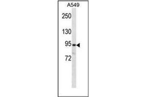 Western blot analysis of PKP3 Antibody (C-term) in A549 cell line lysates (35ug/lane). (Plakophilin 3 antibody  (C-Term))