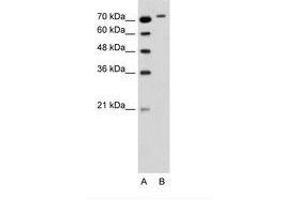 Image no. 2 for anti-rho-Related BTB Domain Containing 1 (RHOBTB1) (C-Term) antibody (ABIN6736347) (RHOBTB1 antibody  (C-Term))