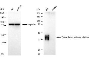 anti-Tissue Factor Pathway Inhibitor (Lipoprotein-Associated Coagulation Inhibitor) (TFPI) antibody