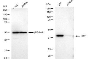 Western blotting analysis using ERK1 antibody (ABIN7799450). (Recombinant ERK1 antibody)