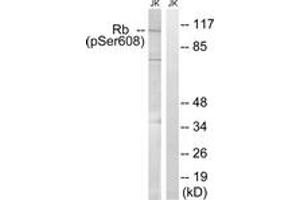 Western blot analysis of extracts from Jurkat cells treated with PMA 125ng/ml 30', using Retinoblastoma (Phospho-Ser608) Antibody. (Retinoblastoma Protein (Rb) antibody  (pSer608))