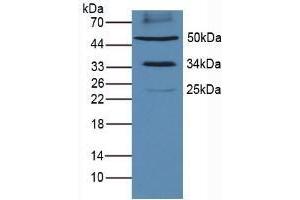 Detection of PDL1 in Mouse Heart Tissue using Polyclonal Antibody to Programmed Cell Death Protein 1 Ligand 1 (PDL1) (PD-L1 antibody  (AA 34-241))