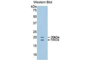 Detection of recombinant CD40L using Polyclonal Antibody to Cluster Of Differentiation 40 Ligand (CD40L) (CD40 Ligand antibody  (AA 111-261))