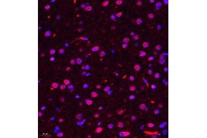 Immunofluorescence of paraffin embedded rat brain using ALS2CR13 (ABIN7073909) at dilution of 1:650 (400x lens) (FAM117B antibody)