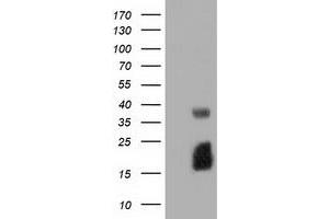 HEK293T cells were transfected with the pCMV6-ENTRY control (Left lane) or pCMV6-ENTRY EFNA2 (Right lane) cDNA for 48 hrs and lysed. (Ephrin A2 antibody)