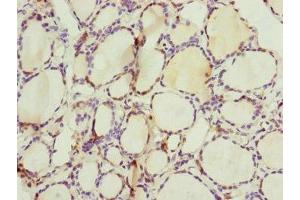 Immunohistochemistry of paraffin-embedded human thyroid tissue using ABIN7147407 at dilution of 1:100 (CEP44 antibody  (AA 1-280))