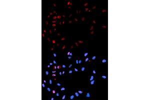 Immunofluorescence analysis of U2OS cells using Phospho-H2AFX-S139 antibody (ABIN5969940). (H2AFX antibody  (pSer139))