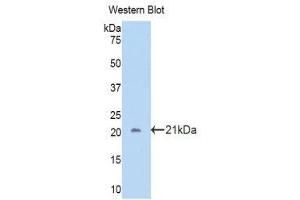 Western Blotting (WB) image for anti-Carbonic Anhydrase 12 (CA12) (AA 161-318) antibody (ABIN3204699) (CA12 antibody  (AA 161-318))
