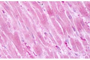 Anti-PTPRA antibody IHC staining of human heart. (PTPRA antibody  (Cytoplasmic Domain))
