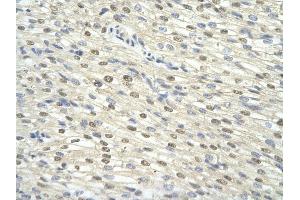 Rabbit Anti-GTF2H3 antibody Catalog Number: ARP31438  Paraffin Embedded Tissue: Human Heart  cell Cellular Data: cardiac cell  Antibody Concentration: 4. (GTF2H3 antibody  (N-Term))