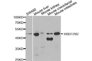 Western blot analysis of extracts of various cell lines, using HSD17B2 antibody. (HSD17B2 antibody)