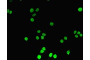 Immunofluorescent analysis of PC-3 cells using ABIN7150213 at dilution of 1:100 and Alexa Fluor 488-congugated AffiniPure Goat Anti-Rabbit IgG(H+L) (TdT antibody  (AA 1-509))