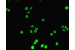 Immunofluorescent analysis of PC-3 cells using ABIN7150213 at dilution of 1:100 and Alexa Fluor 488-congugated AffiniPure Goat Anti-Rabbit IgG(H+L)